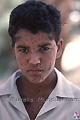 Portrait d'un garçon avec des tâches de naissance sur le visage - EGYPTE